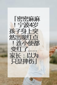 密密麻麻！宁波4岁孩子身上突然出现红点！连小便都变红了……家长：以为只是摔伤